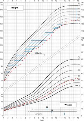 Two Siblings with the Same Severe Form of 21-Hydroxylase Deficiency But Different Growth and Menstrual Cycle Patterns